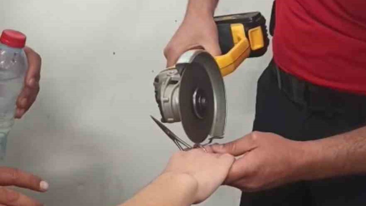 Parmağı makas halkasına sıkıştı, itfaiye kurtardı